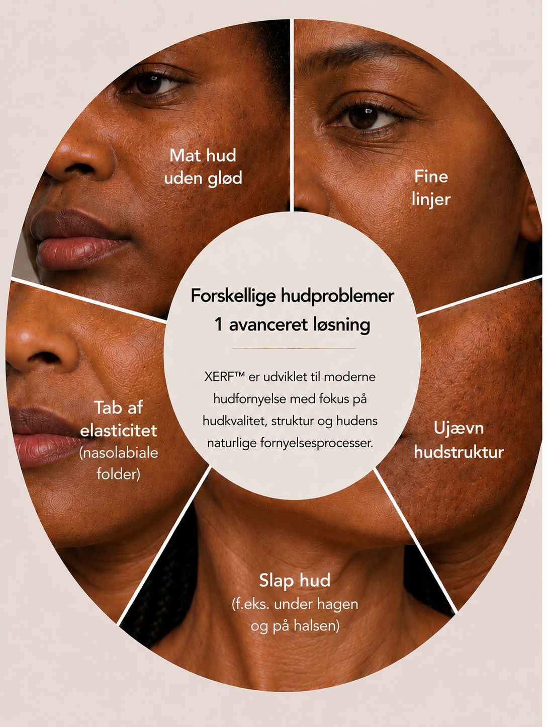 Illustration af almindelige hudproblemer hos personer med mørkere hudtoner, herunder fine linjer, ujævn hudstruktur, tab af elasticitet, slap hud under hagen og på halsen samt mat hud uden glød. I centrum vises XERF™ som en avanceret løsning til moderne hudopstramning, forbedring af hudkvalitet og støtte af hudens naturlige regenereringsprocesser. Grafikken illustrerer, hvordan én behandling kan målrette flere tegn på hudaldring og nedsat hudkvalitet samtidig.